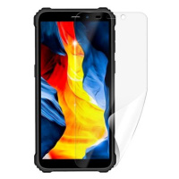 Screenshield OUKITEL WP20 Pro fólie na displej