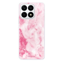 iSaprio RoseMarble 16 pro Honor X8a