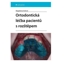 Ortodontická léčba pacientů s rozštěpem