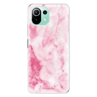 iSaprio RoseMarble 16 pro Xiaomi Mi 11 Lite