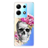 iSaprio Pretty Skull - Infinix Note 30