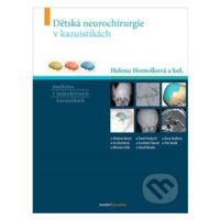 Dětská neurochirurgie v kazuistikách - Helena Homolková - kniha z kategorie Neurochirurgie