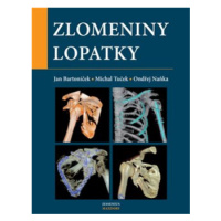 Zlomeniny lopatky - Michal Tuček, Ondřej Naňka, Jan Bartoníček