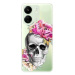 iSaprio Pretty Skull - Xiaomi Redmi 13C