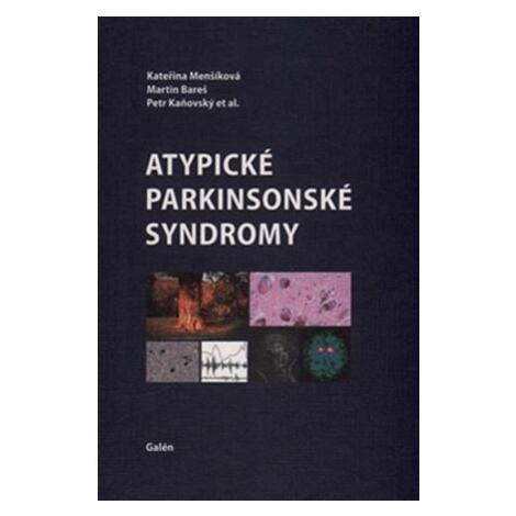 Atypické parkinsonské syndromy Galén