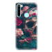 iSaprio Skull in Roses pro Xiaomi Redmi Note 8