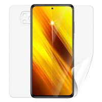 Screenshield POCO X3 Pro na celé tělo