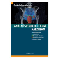 Anální spinocelulární karcinom