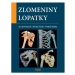 Zlomeniny lopatky