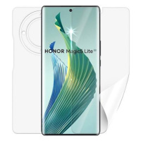 Screenshield HONOR Magic 5 lite 5G fólie na celé tělo