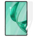 Screenshield HUAWEI Honor Pad X8a fólie na displej