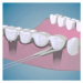 TePe Bridge & Implant Floss zubní nit, 30ks