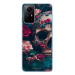 iSaprio Skull in Roses pro Xiaomi Redmi Note 12S