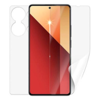 Screenshield XIAOMI Redmi Note 13 Pro fólie na celé tělo