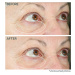 StriVectin TL Hyperlift Eye Instant Eye Fix krém na oční vaky 10 ml