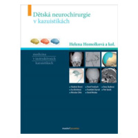 Dětská neurochirurgie v kazuistikách - Helena Homolková, kol.