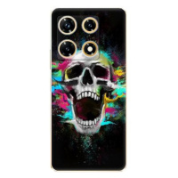 iSaprio Skull in Colors - Infinix Note 30 PRO