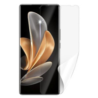 Screenshield VIVO V29 5G fólie na displej