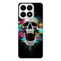 iSaprio Skull in Colors pro Honor X8a