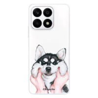 iSaprio Malamute 01 pro Honor X8a