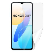 Screenshield HONOR X8 5G fólie na displej