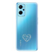 iSaprio čiré pouzdro - Digital Love - Realme 9i