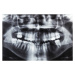 Fotografie Closeup x-ray image of teeth and mouth, jopstock, 40 × 26.7 cm