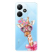 iSaprio Lady Giraffe - Infinix Hot 30i