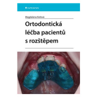 Ortodontická léčba pacientů s rozštěpem - Magdalena Koťová