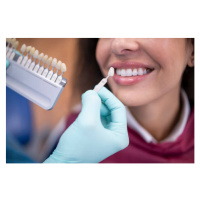 Fotografie Dentist using a palette tooth color sample., ArtistGNDphotography, 40x26.7 cm