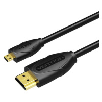 Kabel Vention Micro HDMI Cable 1.5m VAA-D03-B150 (Black)