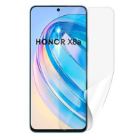 Screenshield HONOR X8a fólie na displej