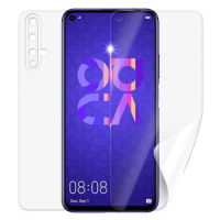 Screenshield HUAWEI Nova 5T na celé tělo