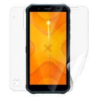 Screenshield MYPHONE Hammer Energy X fólie na celé tělo