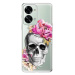 iSaprio Pretty Skull pro OnePlus Nord 2T 5G