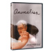 Anomalisa - DVD