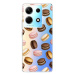 iSaprio Macaron Pattern - Infinix Note 30