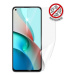 Screenshield pro Anti-Bacteria XIAOMI Mi 11 Lite 5G na displej