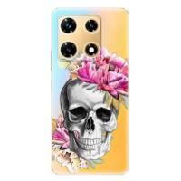 iSaprio Pretty Skull - Infinix Note 30 PRO