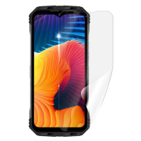 Ochranná fólie Screenshield pro Doogee V30 5G