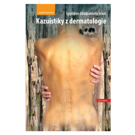 Kazuistiky z dermatologie Maxdorf s.r.o.